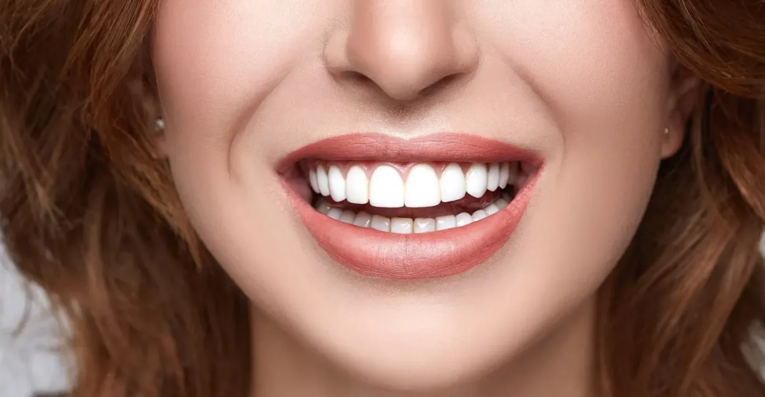 no prep veneers vs traditional veneers inblog